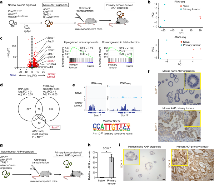 SOX17 enables immune evasion of early colorectal adenomas and cancers