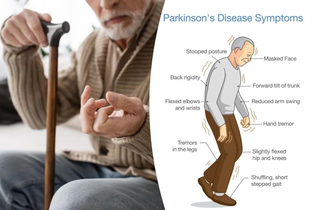 Parkinson’s disease patients may benefit from tandem cycling: study